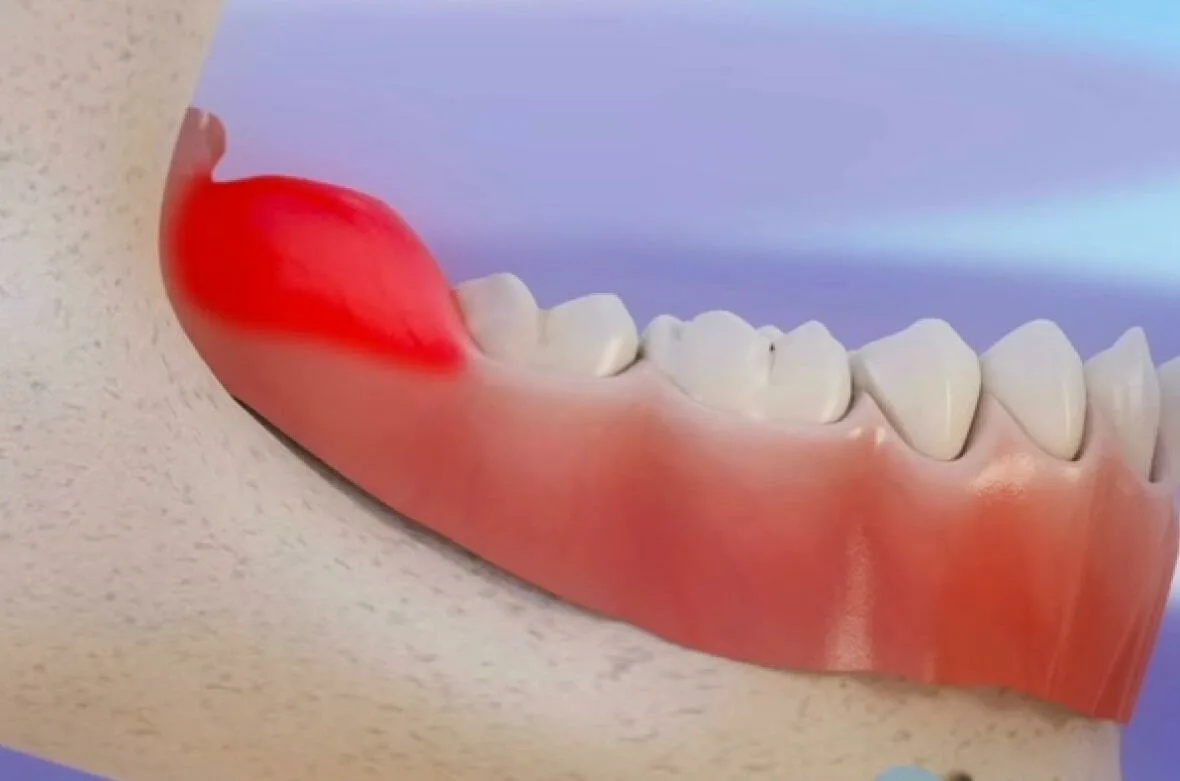 690a60f224db2_1762287858 - изображение на LocalQQ